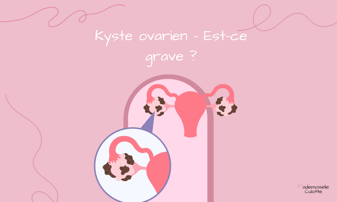 kyste ovarien est-ce grave