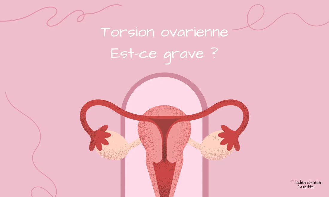 Torsion ovarienne : causes, symptômes et traitements