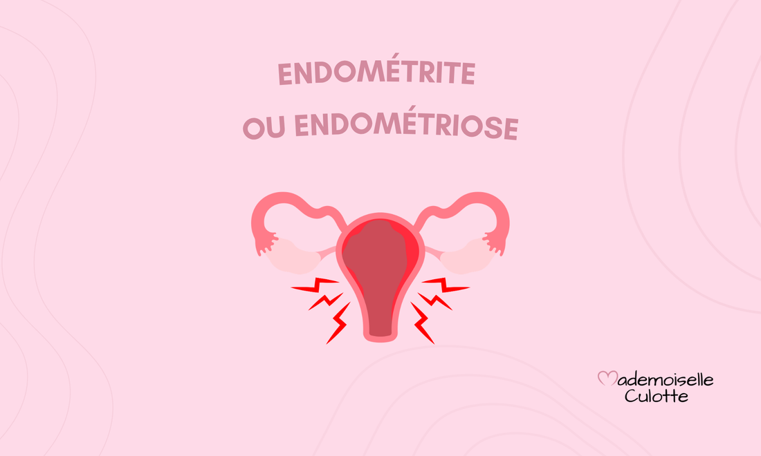 Endométrite ou endométriose : comment faire la différence ?