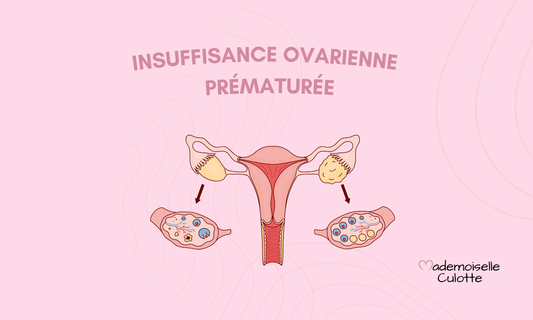 Insuffisance ovarienne prématurée