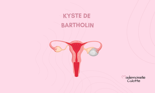 Kyste de Bartholin