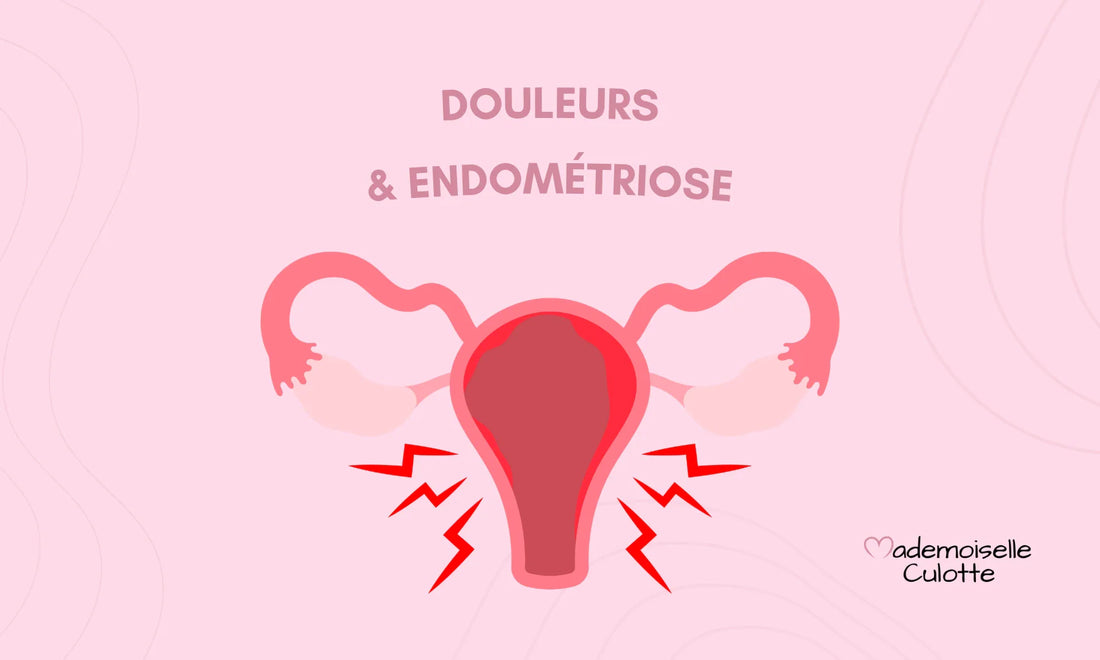 Douleurs et endométriose