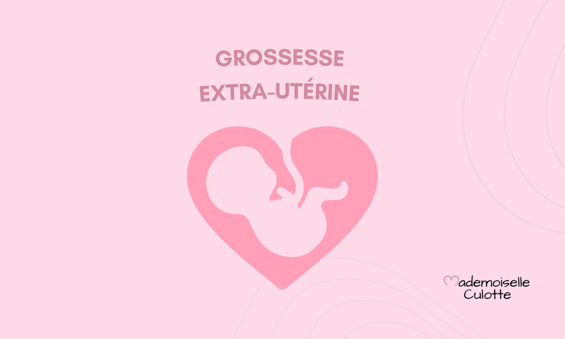 Grossesse extra-utérine