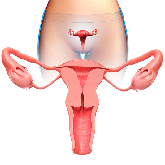 fibrome uterin