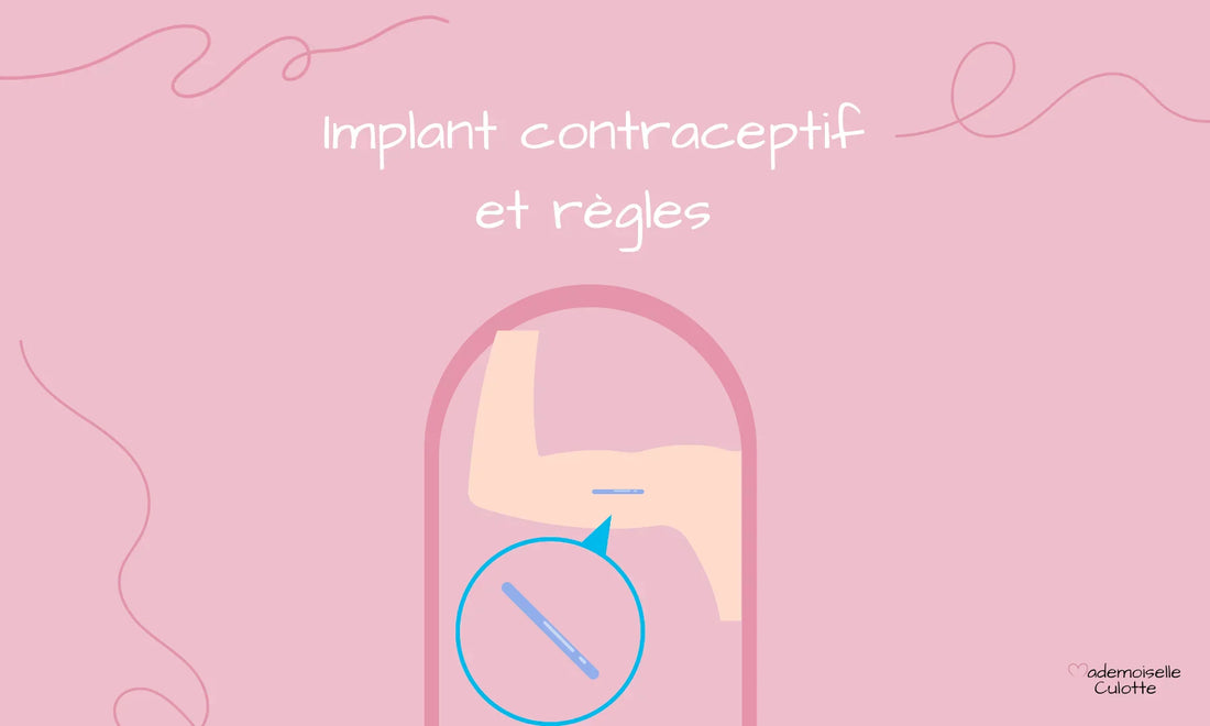 implant contraceptif et effets sur les règles 