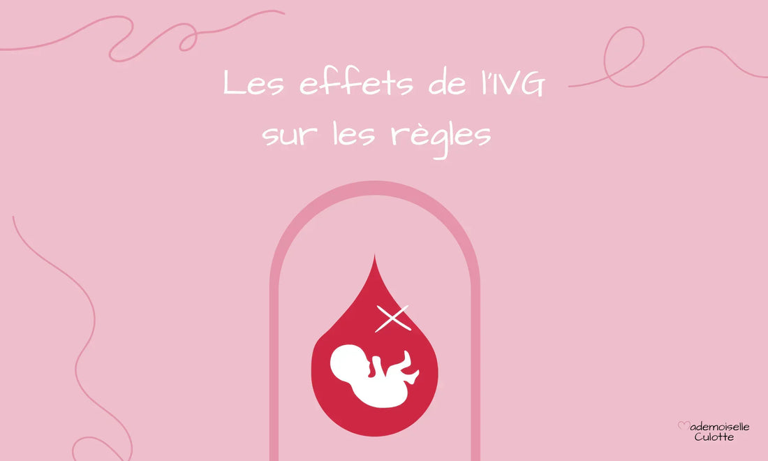 ivg et regles