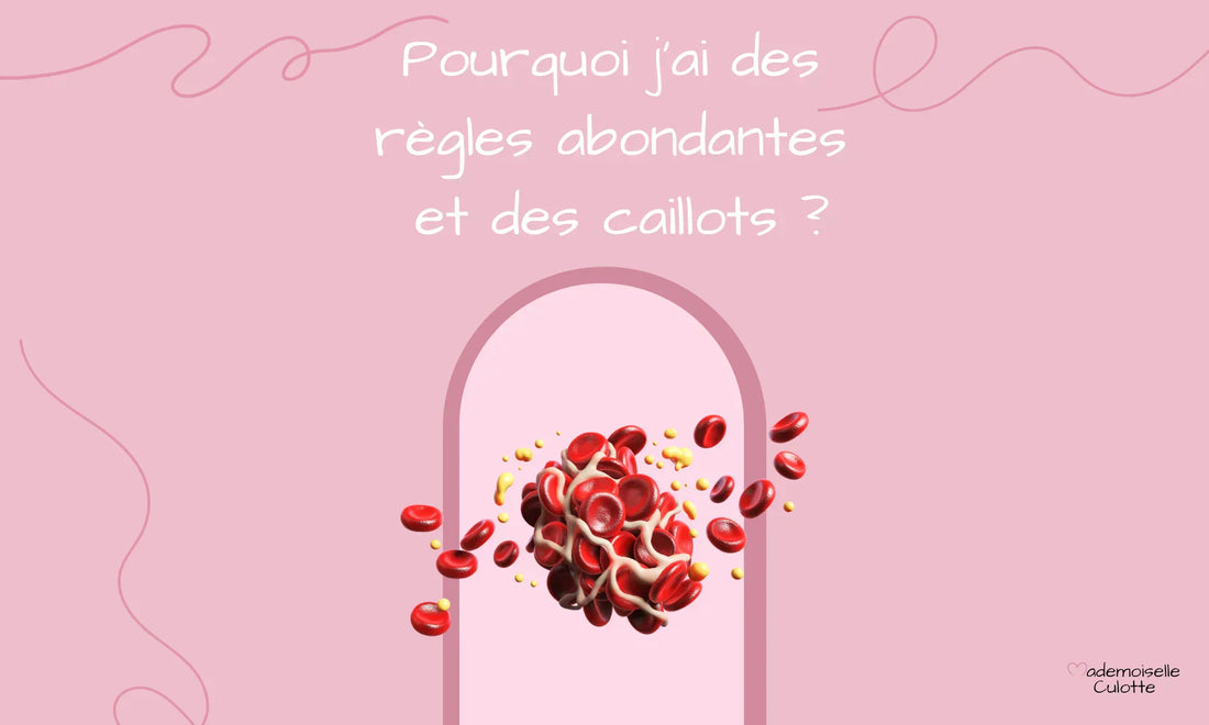 Pourquoi j'ai des règles abondantes et des caillots ?